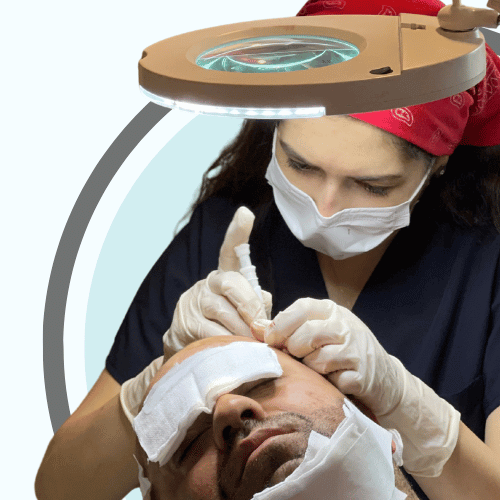 DHI hair transplant at Max Hair center